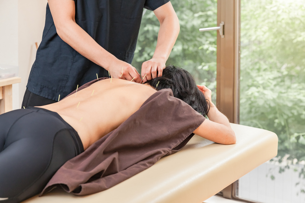 Professional acupuncture treatment in Central London